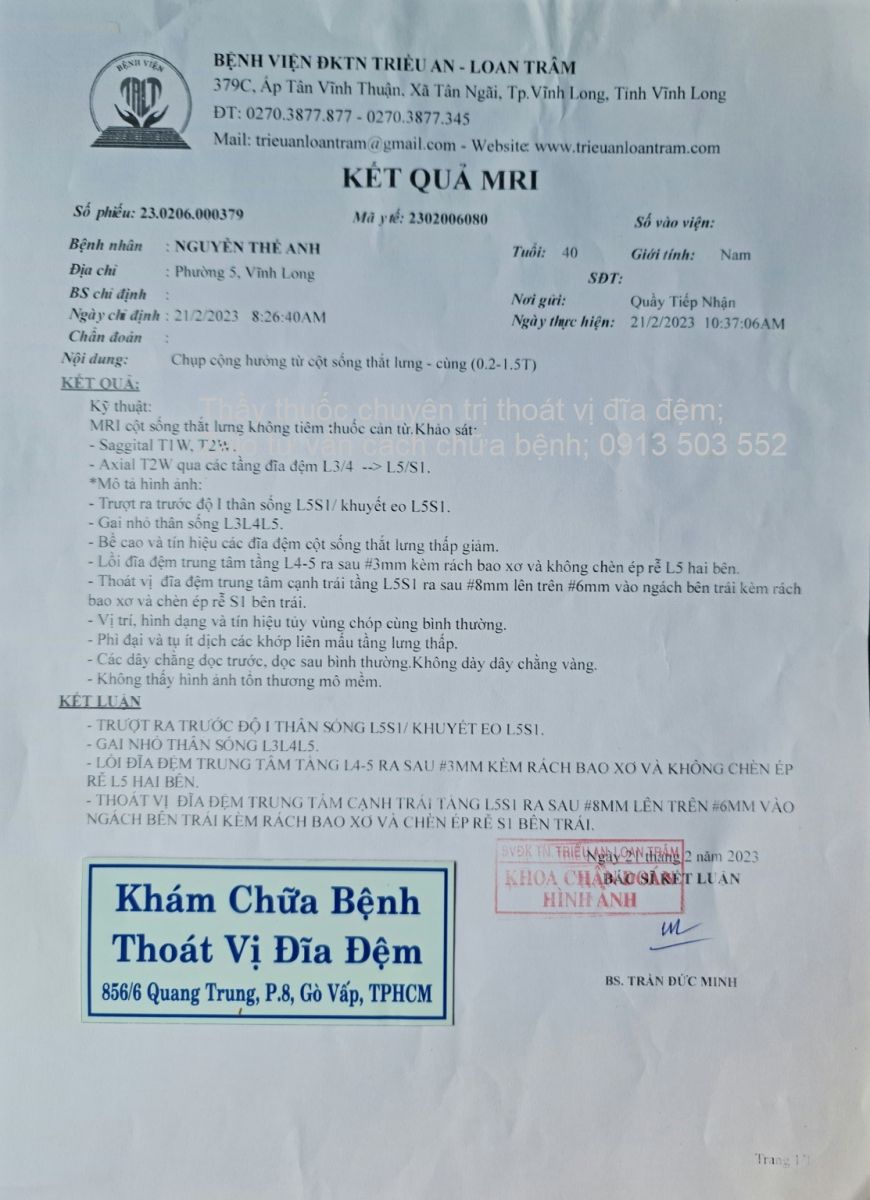 Thoát vị đĩa đệm L5 S1